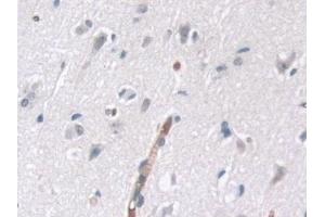 anti-Thiamin Pyrophosphokinase 1 (TPK1) (AA 34-300) antibody