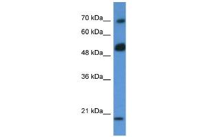 Western Blotting (WB) image for anti-rho GTPase Activating Protein 36 (ARHGAP36) (N-Term) antibody (ABIN406257) (ARHGAP36 anticorps  (N-Term))