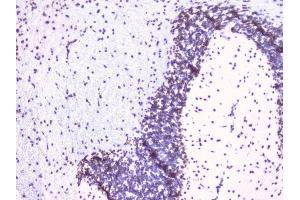 IHC analysis of RbAp48 using anti-RbAp48 antibody (ABIN5692929). (Retinoblastoma Binding Protein 4 anticorps  (C-Term))