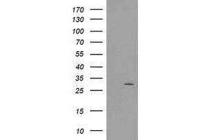 Image no. 3 for anti-CTD (Carboxy-terminal Domain, RNA Polymerase II, Polypeptide A) Small Phosphatase 1 (CTDSP1) antibody (ABIN1497678) (CTDSP1 anticorps)
