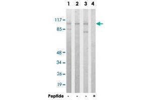 Western blot analysis of extracts from HeLa cells (Lane 1), HepG2 cells (Lane 2) and HUVEC cells (Lane 3 and lane 4), using ACTN2/ACTN3 polyclonal antibody . (ACTN2 anticorps  (N-Term))