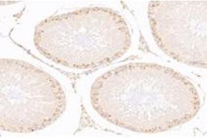 Immunohistochemistry analysis of paraffin-embedded rat testis using,IFNL3 (ABIN7074356) at dilution of 1: 2000 (IL28B anticorps)