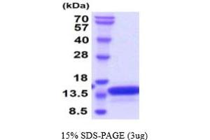 SDS-PAGE (SDS) image for Vesicle-Associated Membrane Protein 2 (Synaptobrevin 2) (VAMP2) (AA 1-94) protein (His tag) (ABIN7281224)