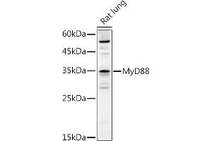 Western blot analysis of extracts of Rat lung, using MyD88 antibody (ABIN6128257, ABIN6144228, ABIN6144229 and ABIN6213986) at 1:1000 dilution. (MYD88 anticorps  (AA 60-309))
