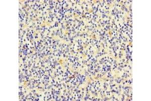 Immunohistochemistry of paraffin-embedded human spleen tissue using ABIN7171488 at dilution of 1:100 (TLN2 anticorps  (AA 88-406))