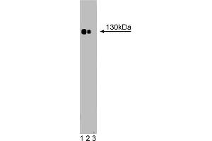 Western Blotting (WB) image for anti-Phospholipase C beta 4 (PLCb4) (AA 752-961) antibody (ABIN968583)