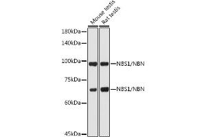 Western blot analysis of extracts of various cell lines, using NBS1/NBS1/NBN antibody (ABIN1681204, ABIN3015326, ABIN3015327 and ABIN5663771) at 1:1000 dilution. (Nibrin anticorps  (AA 435-754))