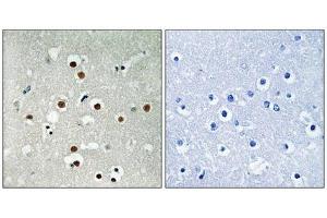 Immunohistochemical analysis of paraffin-embedded human brain tissue using MEF2C (Phospho-Ser396) antibody (left)or the same antibody preincubated with blocking peptide (right). (MEF2C anticorps  (pSer396))