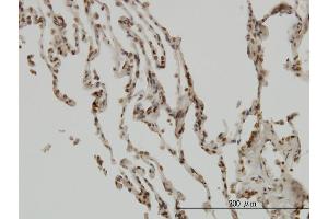 Immunoperoxidase of monoclonal antibody to NFKBIB on formalin-fixed paraffin-embedded human lung.