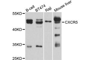 Western blot analysis of extracts of various cell lines, using CXCR5 antibody (ABIN5995664) at 1/1000 dilution. (CXCR5 anticorps)