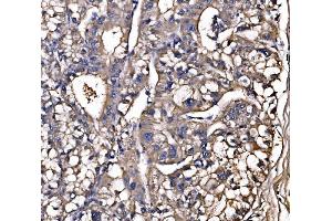 IHC analysis of LSR using anti-LSR antibody (ABIN7599514).