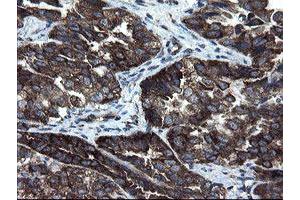 Image no. 4 for anti-CCR4-NOT Transcription Complex Subunit 4 (CNOT4) (AA 190-455) antibody (ABIN1491098) (CNOT4 anticorps  (AA 190-455))