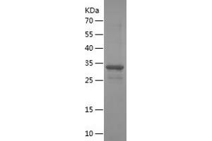 Western Blotting (WB) image for Transcription Factor AP-2 beta (Activating Enhancer Binding Protein 2 Beta) (TFAP2B) (AA 173-460) protein (His tag) (ABIN7125442) (TFAP2B Protein (AA 173-460) (His tag))