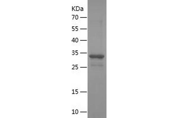 TFAP2B Protein (AA 173-460) (His tag)