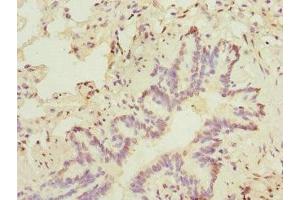 Immunohistochemistry of paraffin-embedded human lung tissue using ABIN7172635 at dilution of 1:100