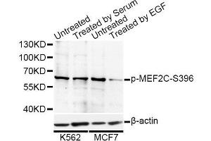 Western blot analysis of extracts of K-562 and MCF-7 cells, using Phospho-MEF2C-S396 antibody (ABIN5969920) at 1/1000 dilution. (MEF2C anticorps  (pSer396))