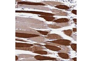 Immunohistochemical staining of human skeletal muscle with LOC653192 polyclonal antibody  shows strong cytoplasmic positivity in myocytes at 1:50-1:200 dilution. (TRIM43 anticorps)