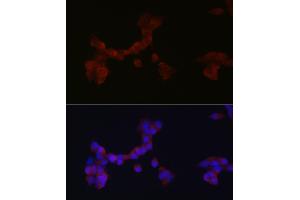 Immunofluorescence analysis of SH-SY5Y cells using D Rabbit pAb (ABIN6130320, ABIN6139385, ABIN6139386 and ABIN6214572) at dilution of 1:250 (40x lens). (DAB1 anticorps  (AA 1-185))
