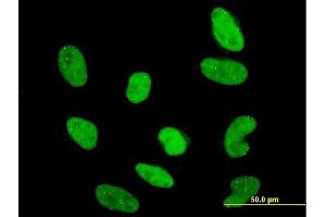 Immunofluorescence of monoclonal antibody to RAX on HeLa cell. (RAX anticorps  (AA 104-206))