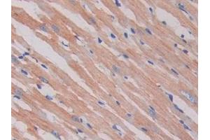 Detection of SIGIRR in Rat Heart Tissue using Polyclonal Antibody to Single Ig IL1 Related Receptor (SIGIRR)