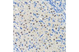 Immunohistochemistry of paraffin-embedded rat ovary using PIM1 antibody (ABIN7269375) at dilution of 1:100 (40x lens).