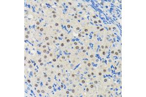 Immunohistochemistry of paraffin-embedded rat ovary using PIM1 antibody (ABIN7269375) at dilution of 1:100 (40x lens). (PIM1 anticorps)