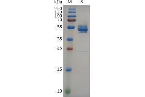 Human Protein, hFc Tag on SDS-PAGE under reducing condition.