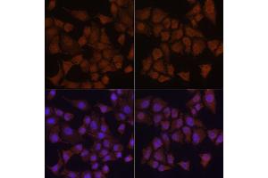 Immunofluorescence analysis of HeLa cells using MAP1LC3B antibody. (LC3B anticorps)