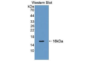 Western blot analysis of the recombinant protein. (Cytokeratin 7 anticorps  (AA 394-457))
