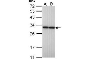 WB Image Sample (30 ug of whole cell lysate) A: H1299 B: Hela 12% SDS PAGE antibody diluted at 1:10000 (PGAM2 anticorps)