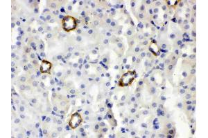 IHC analysis of ISG15/Ucrp using anti- ISG15/Ucrp antibody .