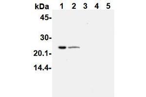 Western Blotting (WB) image for anti-PYD and CARD Domain Containing (PYCARD) antibody (ABIN1105662) (PYCARD anticorps)