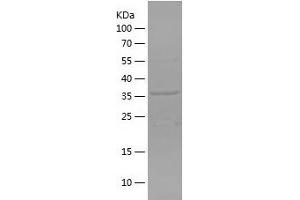 Western Blotting (WB) image for Eukaryotic Translation Initiation Factor 2C, 1 (EIF2C1) (AA 705-857) protein (His-IF2DI Tag) (ABIN7122843)