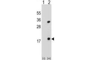 Western Blotting (WB) image for anti-Phospholipase A2, Group IB (PLA2G1B) antibody (ABIN3002154)