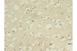 Immunohistochemistry of paraffin-embedded human brain tissue using ABIN7156983 at dilution of 1:100