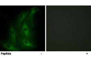 Immunofluorescence analysis of HeLa cells, using COL4A6 polyclonal antibody . (COL4a6 anticorps)