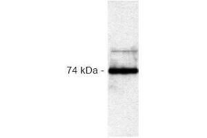 Western Blotting (WB) image for anti-V-Raf-1 Murine Leukemia Viral Oncogene Homolog 1 (RAF1) antibody (ABIN126882) (RAF1 anticorps)