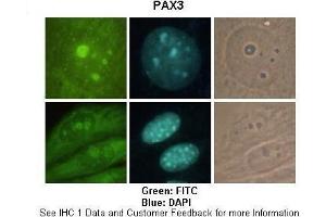 Sample Type :  Mouse B16F10  Primary Antibody Dilution :   1:200  Secondary Antibody :  Goat anti-rabbit-FITC  Secondary Antibody Dilution :   1:800  Color/Signal Descriptions :  Green: FITC Blue: DAPI  Gene Name :  PAX3  Submitted by :  Tsu Fang Wu, Institute of Molecular Biology, National Chung Hsing University (Paired Box 3 anticorps  (C-Term))
