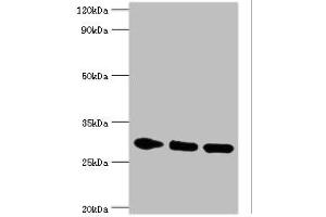 Western blot All lanes: PRKAB2 antibody at 5 μg/mL Lane 1: Rat brain tissue Lane 2: Mouse heart tissue Lane 3: Mouse gonad tissue Secondary Goat polyclonal to rabbit IgG at 1/10000 dilution Predicted band size: 31, 22 kDa Observed band size: 31 kDa (PRKAB2 anticorps  (AA 1-272))