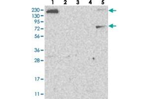 Western blot analysis of Lane 1: RT-4, Lane 2: U-251 MG, Lane 3: Human Plasma, Lane 4: Liver, Lane 5: Tonsil with FAM83H polyclonal antibody  at 1:250-1:500 dilution.