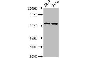 Western Blot Positive WB detected in: 293T whole cell lysate, Hela whole cell lysate All lanes: EPOR antibody at 4. (EPOR anticorps  (AA 320-506))