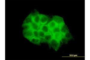 Immunofluorescence of monoclonal antibody to DVL3 on A-431 cell.