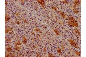 IHC image of ABIN7147133 diluted at 1:100 and staining in paraffin-embedded human spleen tissue performed on a Leica BondTM system.