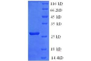 Glutathione S-Transferase pi 1 (GSTP1) (AA 2-210), (full length) protein (His tag)