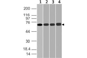 Image no. 1 for anti-DEAD (Asp-Glu-Ala-Asp) Box Polypeptide 3, X-Linked (DDX3X) (AA 10-230) antibody (ABIN5027138) (DDX3X anticorps  (AA 10-230))