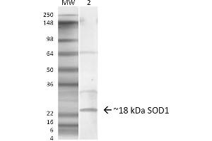 Western blot analysis of Mouse Lung showing detection of ~18 kDa SOD1 (EDI) protein using Rabbit Anti-SOD1 (EDI) Polyclonal Antibody . (SOD1 anticorps  (C-Term) (PerCP))