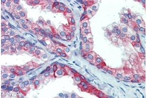 Prostate, Human: Formalin-Fixed, Paraffin-Embedded (FFPE)