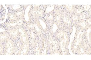 Detection of PAI1 in Human Kidney Tissue using Monoclonal Antibody to Plasminogen Activator Inhibitor 1 (PAI1)