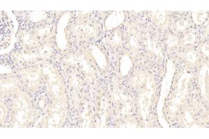 Detection of PAI1 in Human Kidney Tissue using Monoclonal Antibody to Plasminogen Activator Inhibitor 1 (PAI1) (PAI1 anticorps)