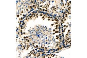Immunohistochemistry of paraffin embedded rat testis using RNF7 (ABIN7075471) at dilution of 1:1000 (400x lens) (RNF7 anticorps)